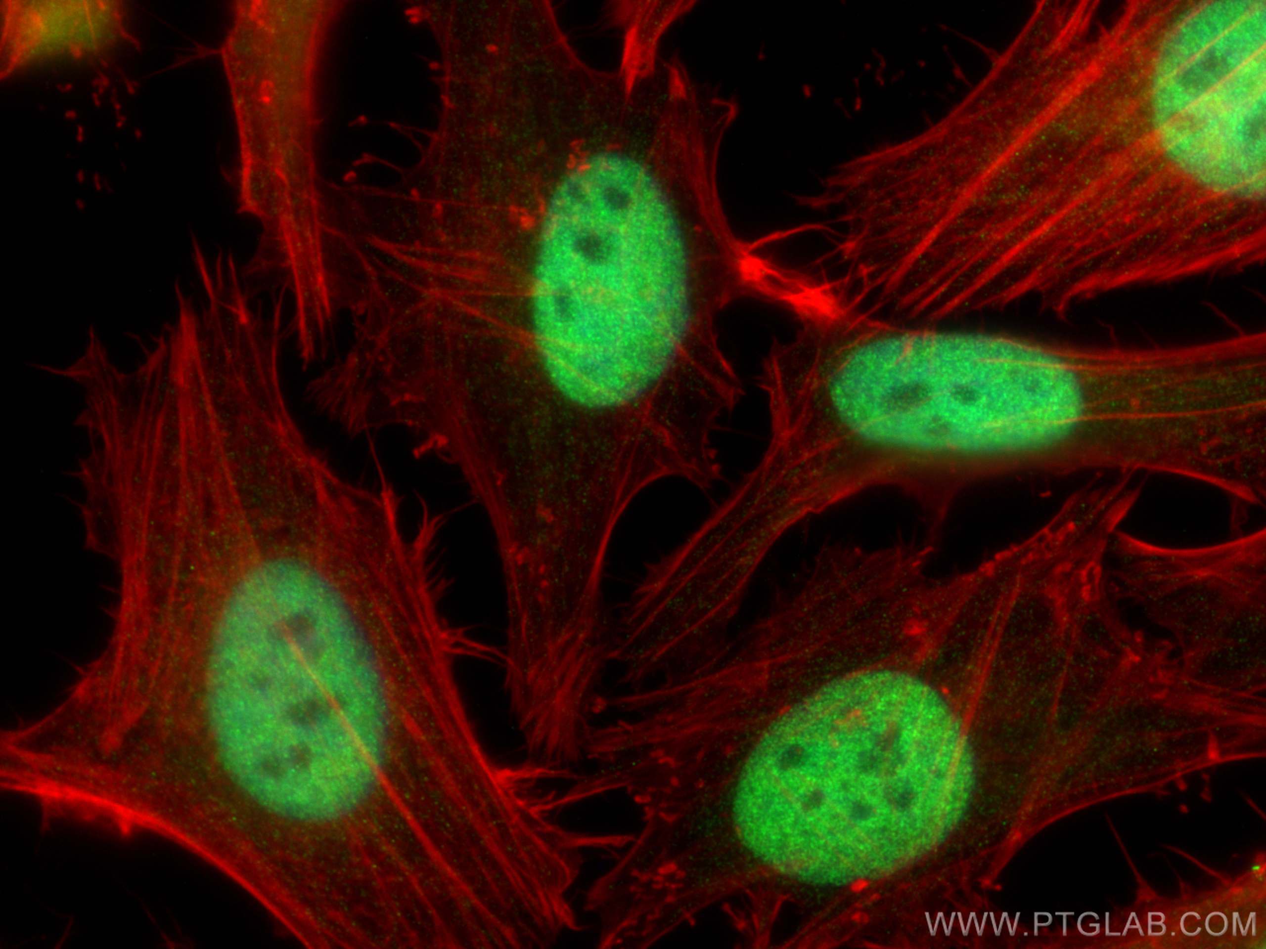 Immunofluorescence (IF) / fluorescent staining of HeLa cells using CUL4B Polyclonal antibody (12916-1-AP)