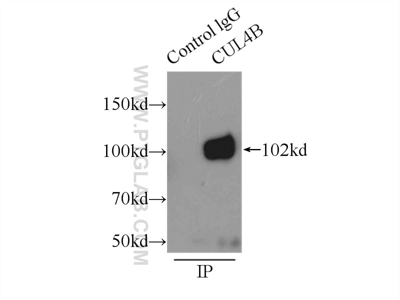 Immunoprecipitation (IP) experiment of HeLa cells using CUL4B Polyclonal antibody (12916-1-AP)