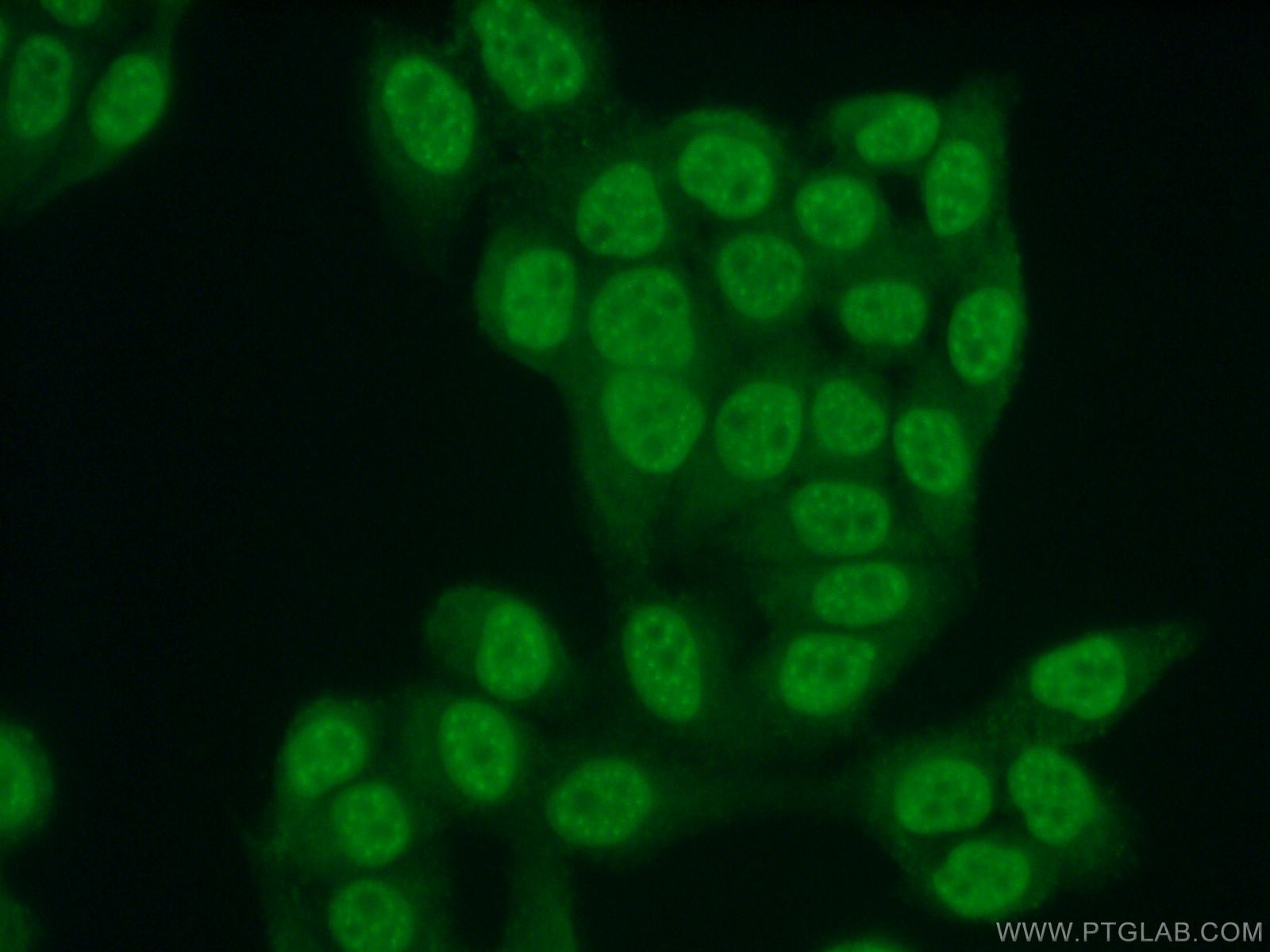 IF Staining of HeLa using 20882-1-AP