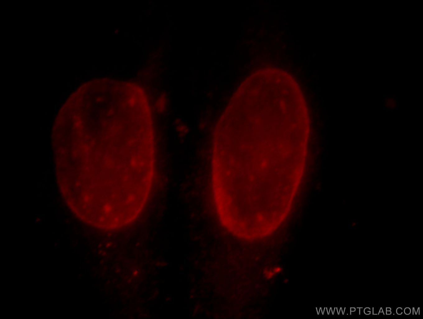 Immunofluorescence (IF) / fluorescent staining of HepG2 cells using CUL4B Polyclonal antibody (20882-1-AP)