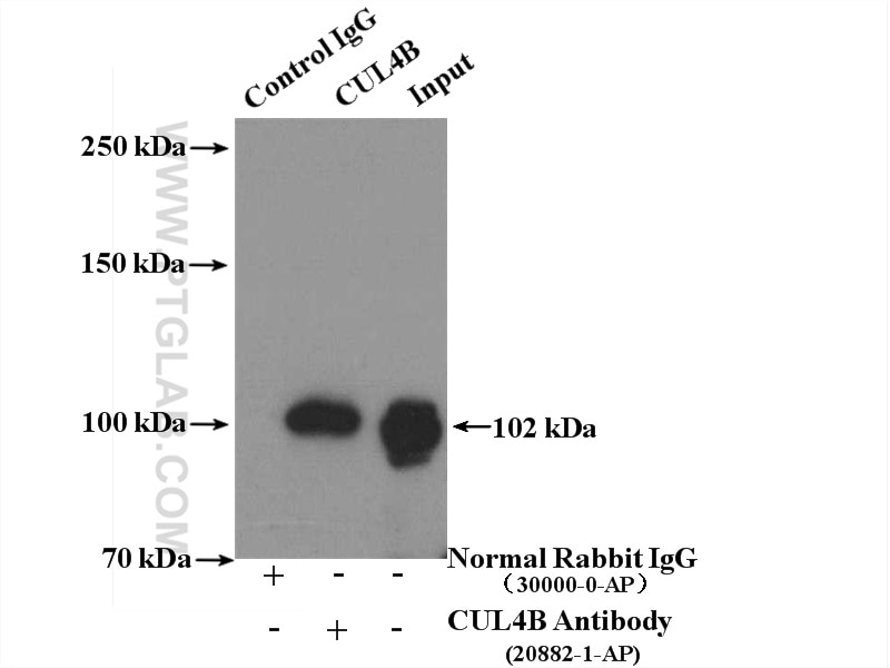 Immunoprecipitation (IP) experiment of mouse brain tissue using CUL4B Polyclonal antibody (20882-1-AP)
