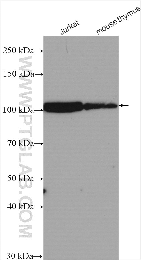 Western Blot (WB) analysis of various lysates using CUL4B Polyclonal antibody (20882-1-AP)