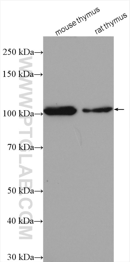 Western Blot (WB) analysis of various lysates using CUL4B Polyclonal antibody (20882-1-AP)