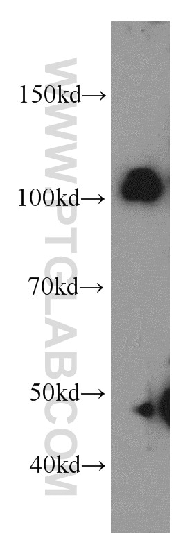 Western Blot (WB) analysis of Y79 cells using CUL4B Polyclonal antibody (20882-1-AP)
