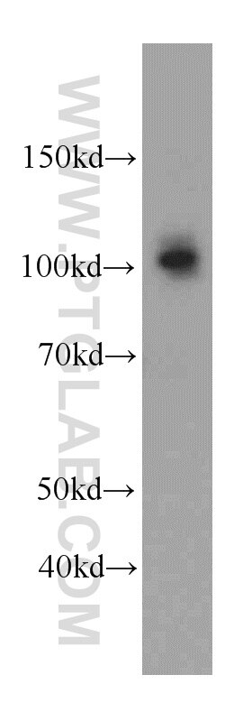 Western Blot (WB) analysis of mouse thymus tissue using CUL4B Polyclonal antibody (20882-1-AP)