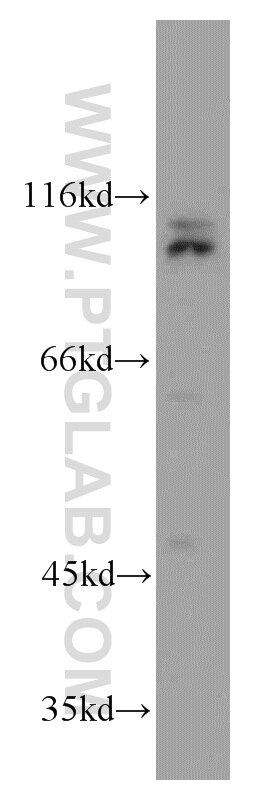 Western Blot (WB) analysis of SH-SY5Y cells using CUL4B Polyclonal antibody (20882-1-AP)