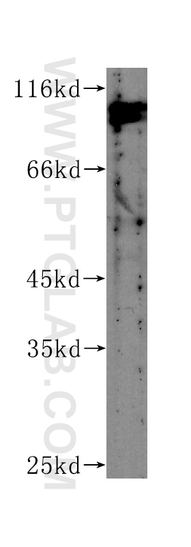 Western Blot (WB) analysis of HEK-293 cells using CUL4B Monoclonal antibody (60151-1-Ig)