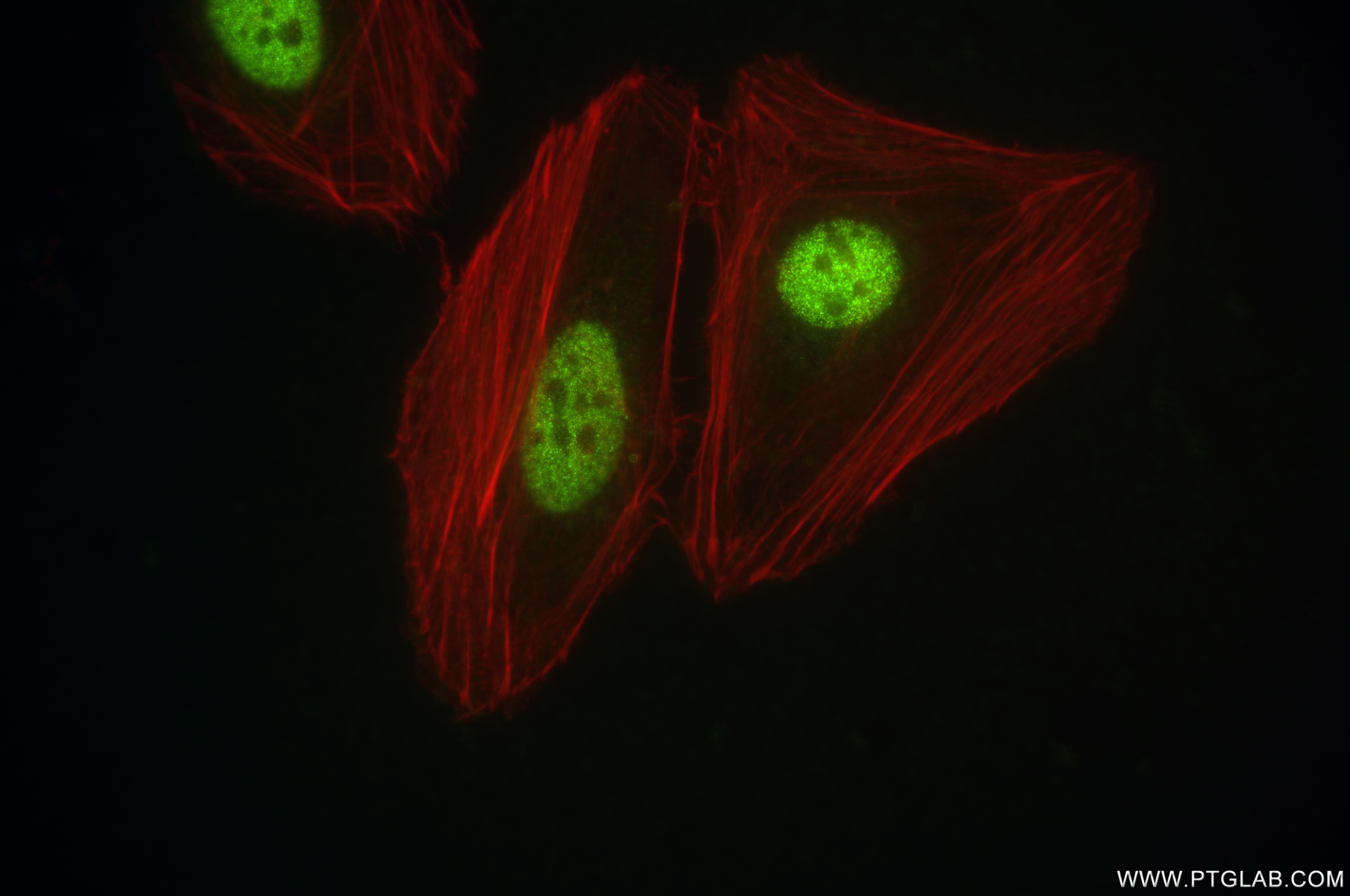 Immunofluorescence (IF) / fluorescent staining of HeLa cells using CUL4B Recombinant antibody (85001-4-RR)