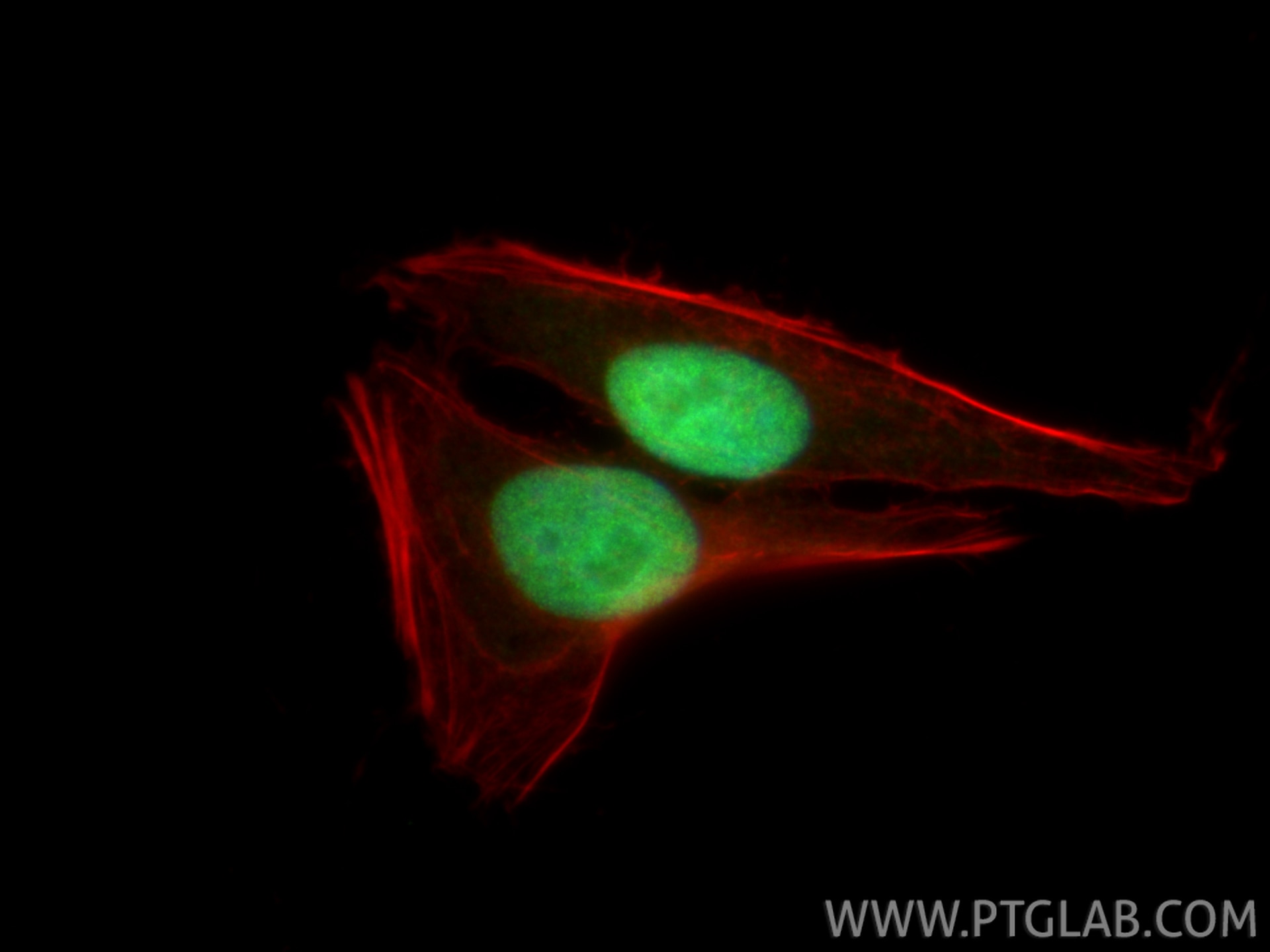 IF Staining of HepG2 using 85001-4-RR Immunofluorescence (IF) / fluorescent staining of HepG2 cells using CUL4B Recombinant monoclonal antibody (85001-4-RR)
