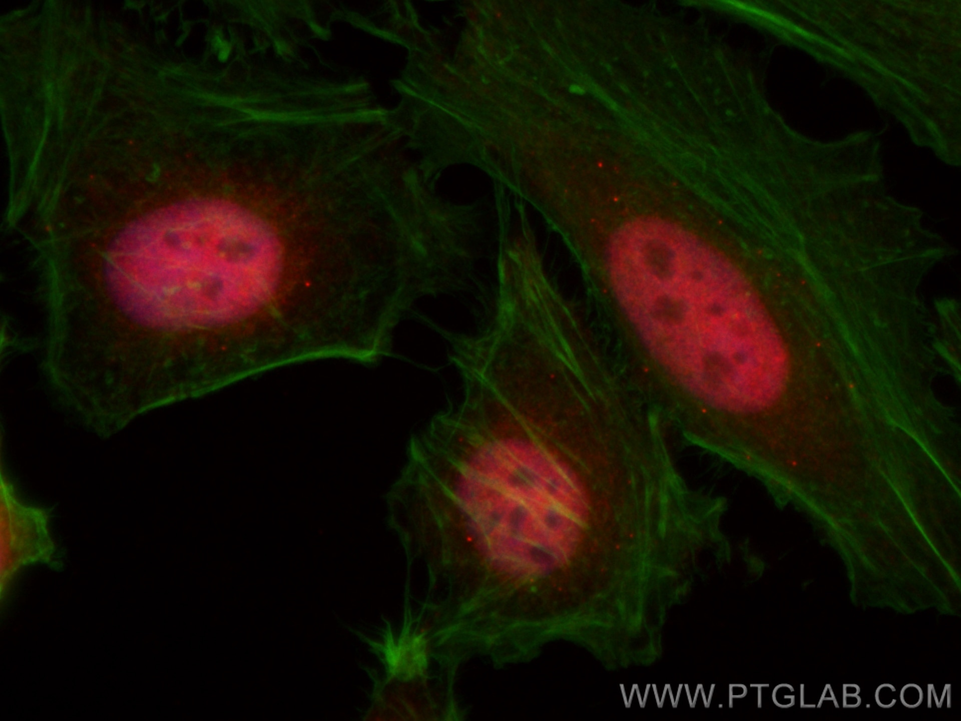 Immunofluorescence (IF) / fluorescent staining of HeLa cells using CoraLite®594-conjugated CUL4B Polyclonal antibody (CL594-12916)