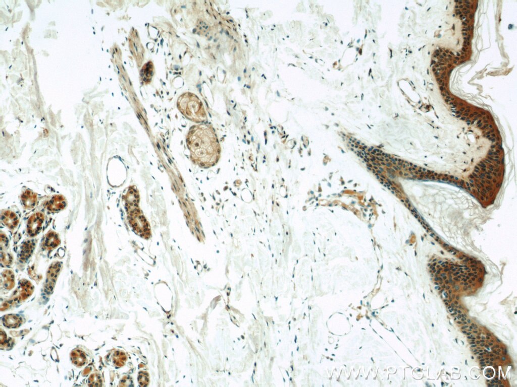 Immunohistochemistry (IHC) staining of human skin tissue using Cullin 5 Monoclonal antibody (60093-1-Ig)