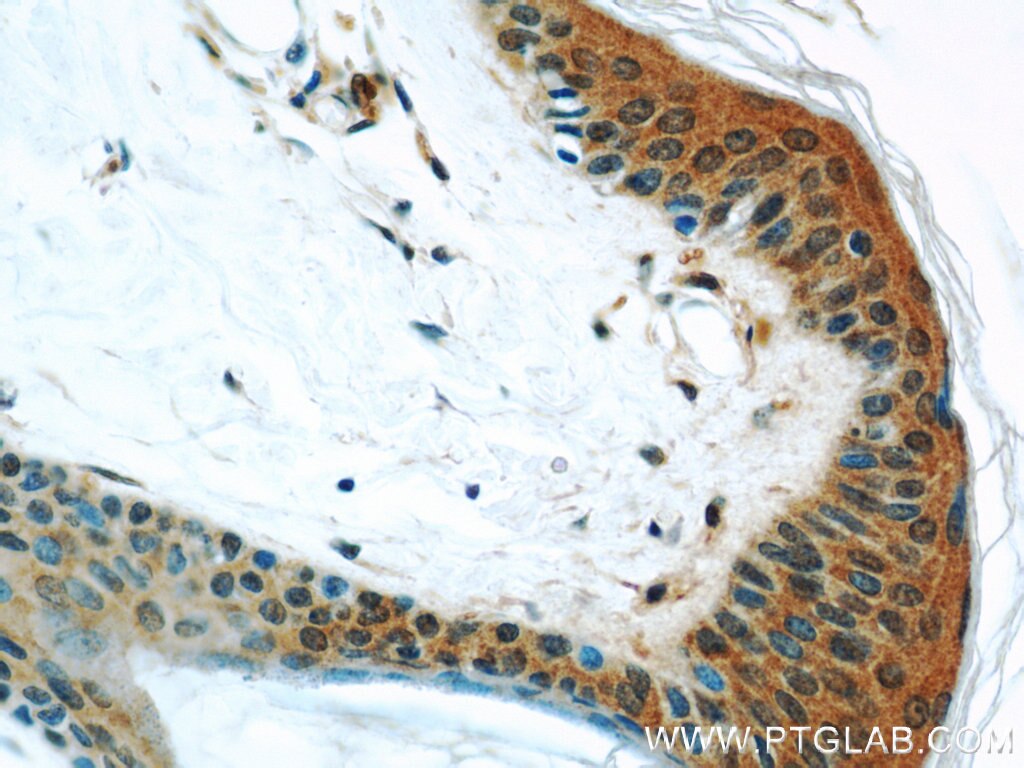 Immunohistochemistry (IHC) staining of human skin tissue using Cullin 5 Monoclonal antibody (60093-1-Ig)