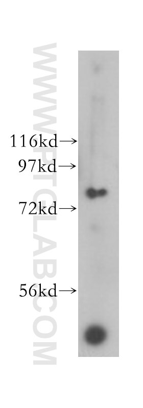 Western Blot (WB) analysis of Y79 cells using Cullin 5 Monoclonal antibody (60093-1-Ig)