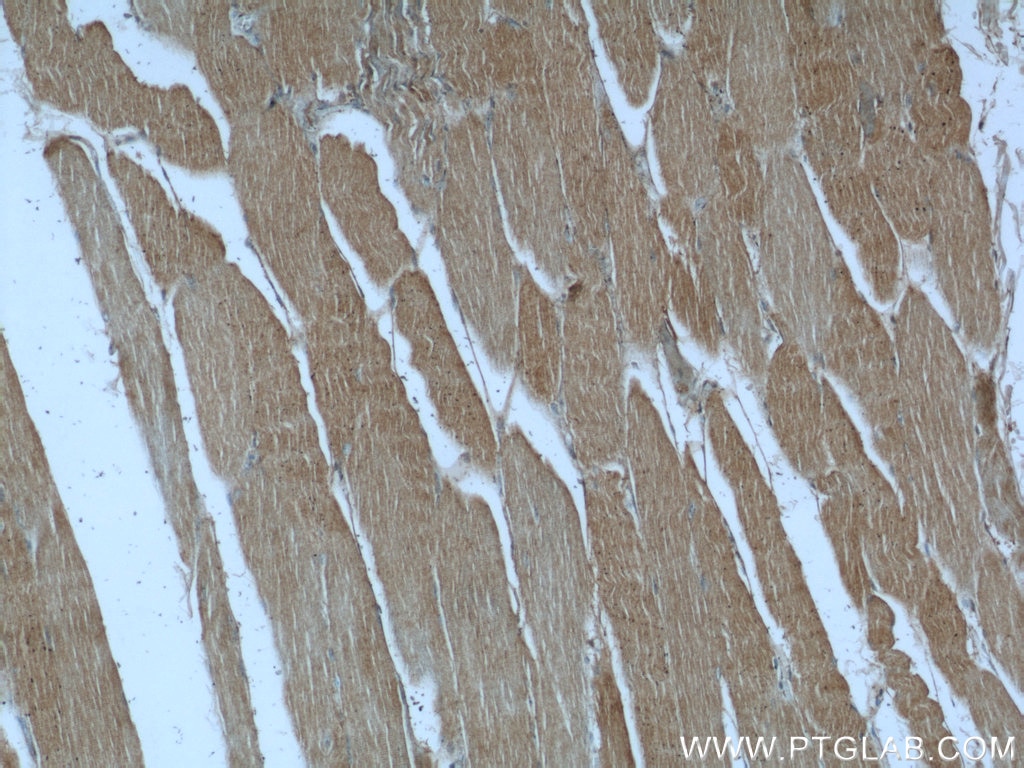 IHC staining of human skeletal muscle using 13738-1-AP