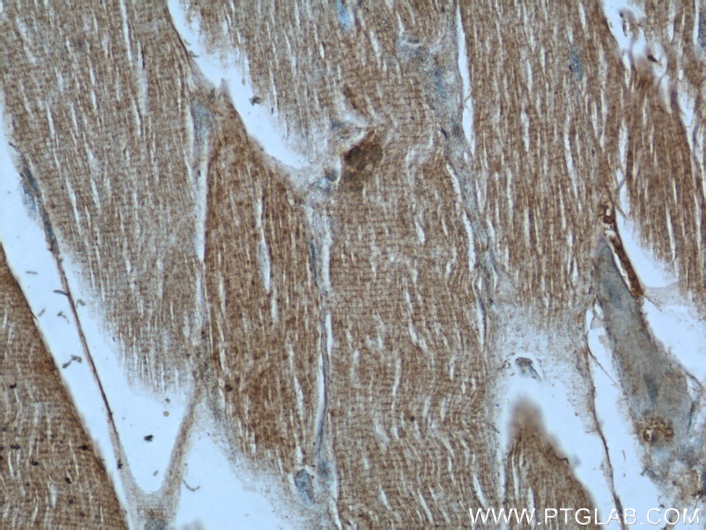 IHC staining of human skeletal muscle using 13738-1-AP