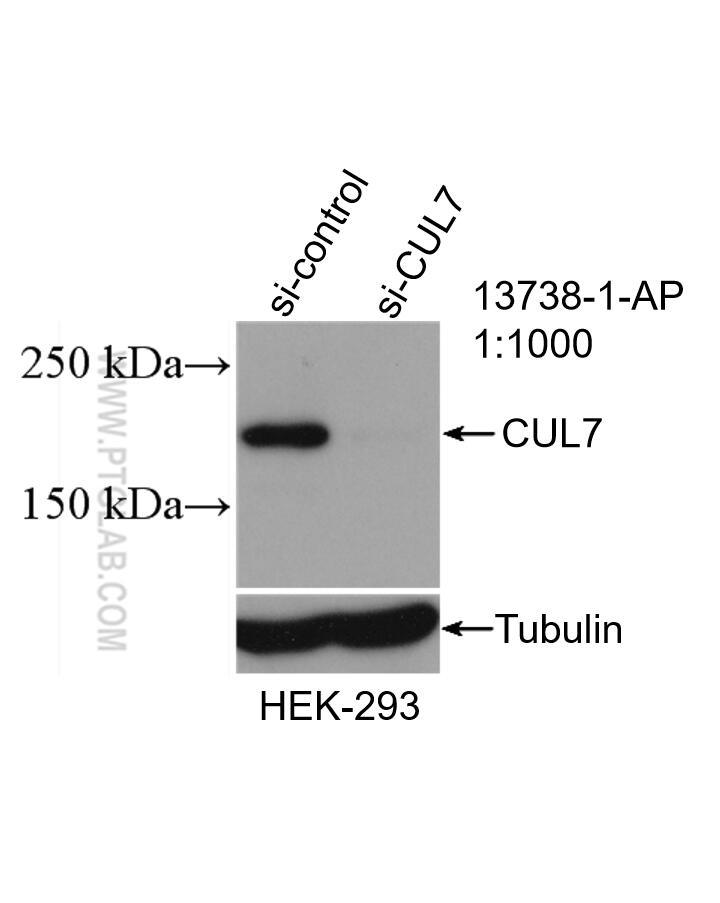Western Blot (WB) analysis of HEK-293 cells using CUL7 Polyclonal antibody (13738-1-AP)