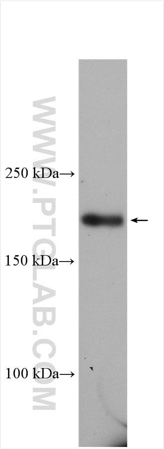 Western Blot (WB) analysis of HEK-293 cells using CUL7 Polyclonal antibody (13738-1-AP)