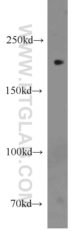 CUL7 Polyclonal antibody