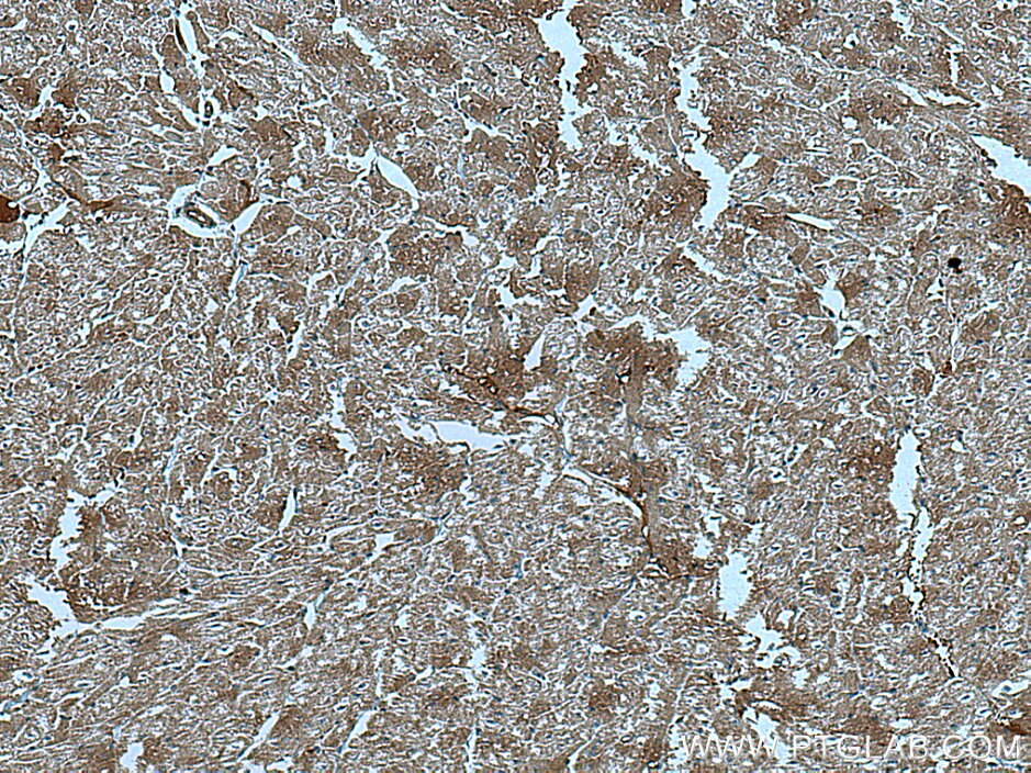 Immunohistochemistry (IHC) staining of human heart tissue using CUL7 Monoclonal antibody (67034-1-Ig)