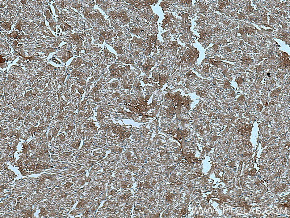 Immunohistochemistry (IHC) staining of human heart tissue using CUL7 Monoclonal antibody (67034-1-Ig)