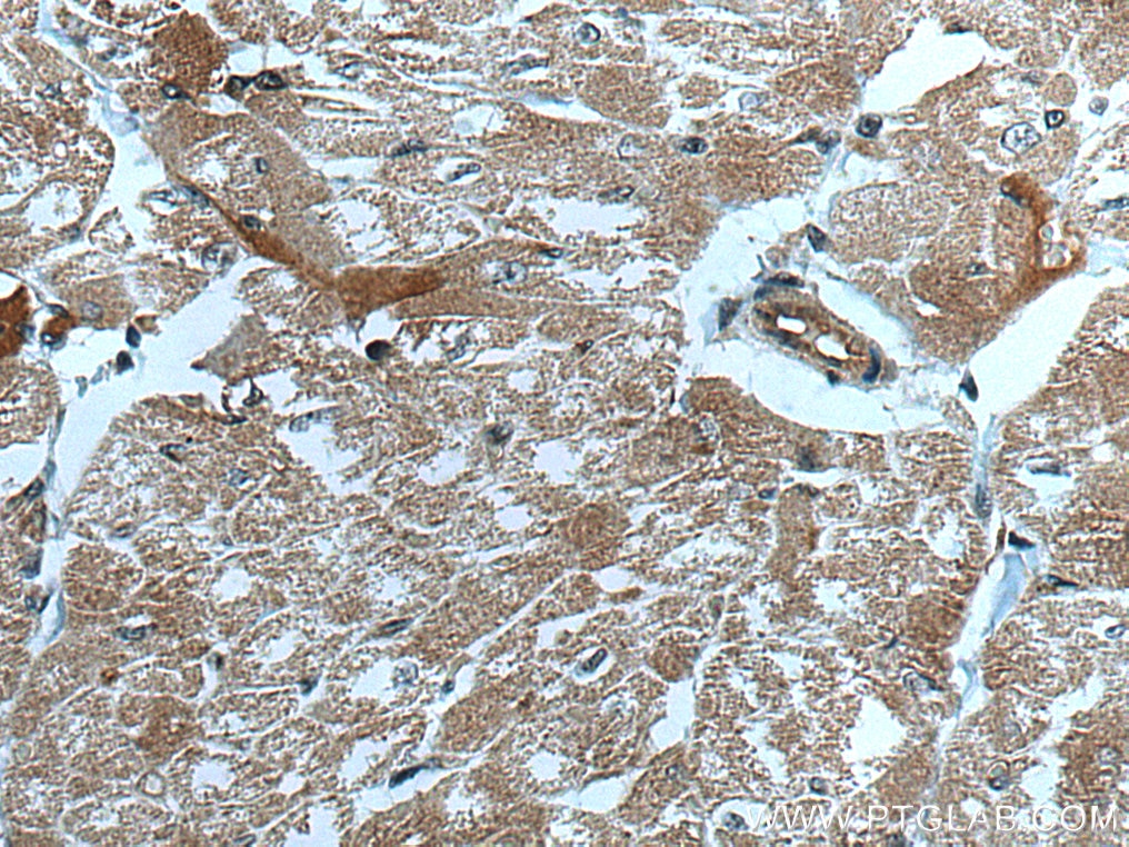 Immunohistochemistry (IHC) staining of human heart tissue using CUL7 Monoclonal antibody (67034-1-Ig)