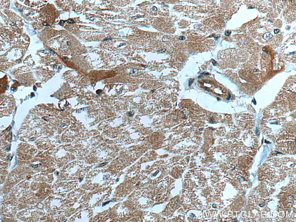 IHC staining of human heart using 67034-1-Ig