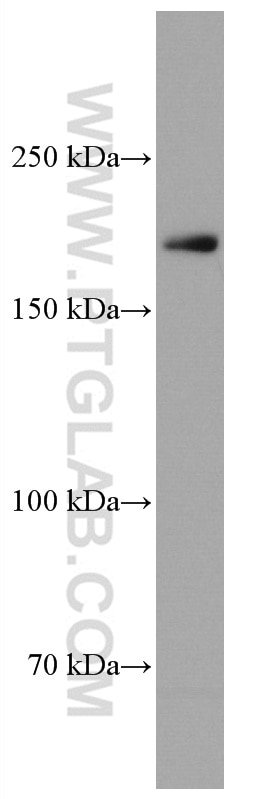 Western Blot (WB) analysis of NCI-H1299 cells using CUL7 Monoclonal antibody (67034-1-Ig)