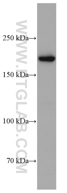 Western Blot (WB) analysis of HSC-T6 cells using CUL7 Monoclonal antibody (67034-1-Ig)