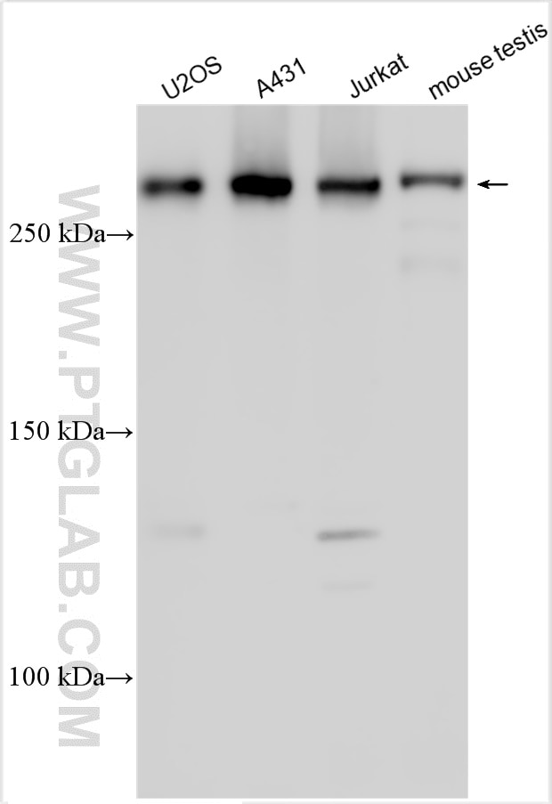 Western Blot (WB) analysis of various lysates using CUL9 Polyclonal antibody (31220-1-AP)