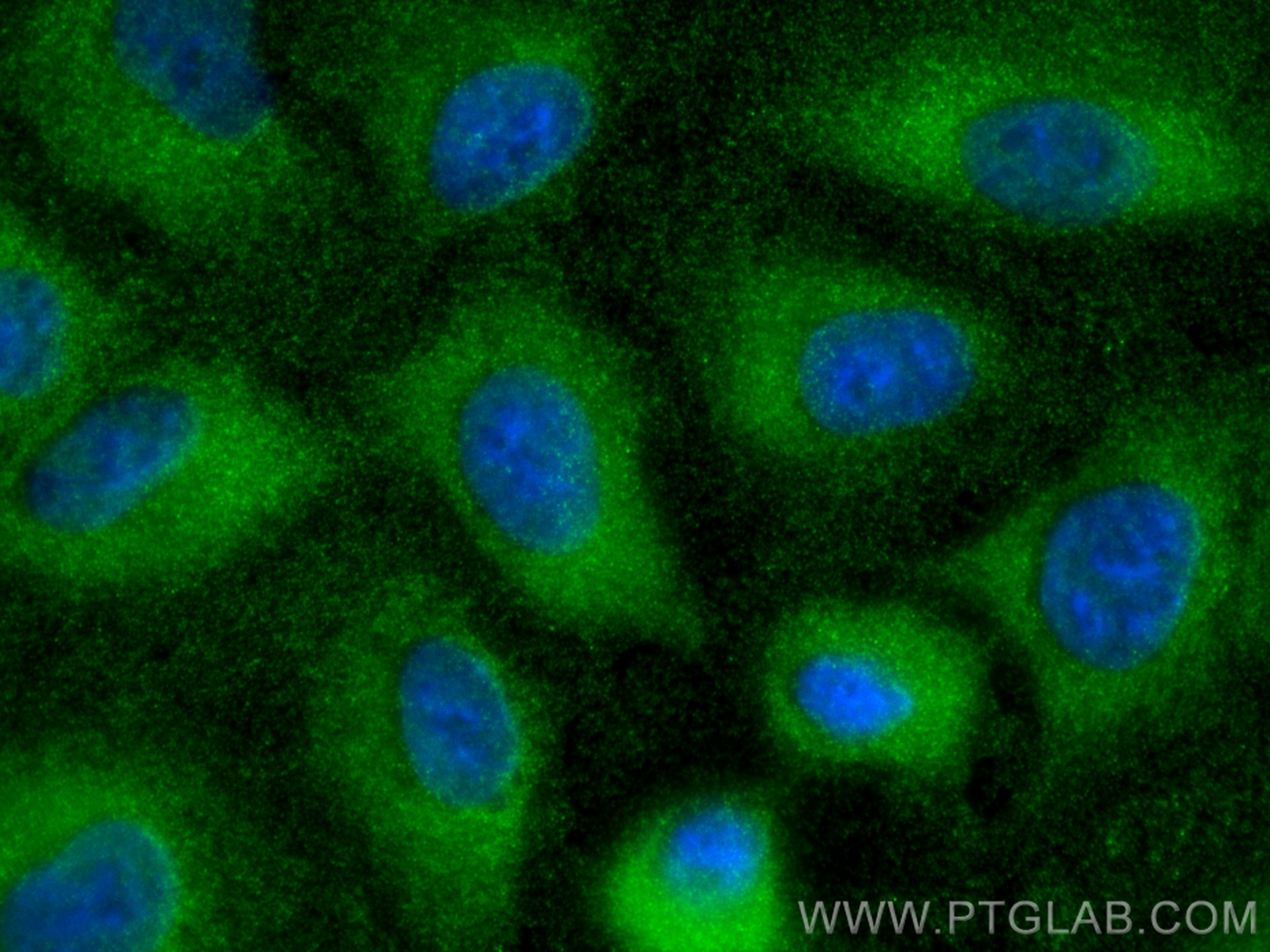 Immunofluorescence (IF) / fluorescent staining of A549 cells using CUTA Polyclonal antibody (15610-1-AP)