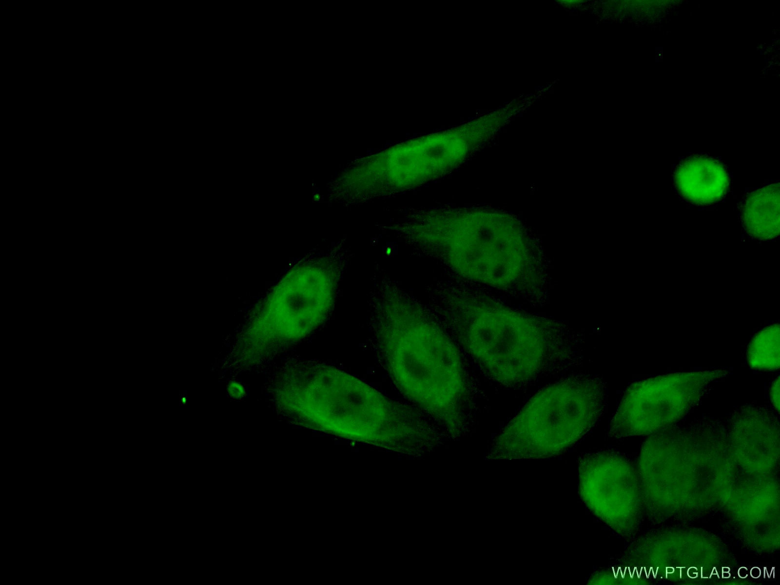 Immunofluorescence (IF) / fluorescent staining of HeLa cells using CUTC Polyclonal antibody (15030-1-AP)