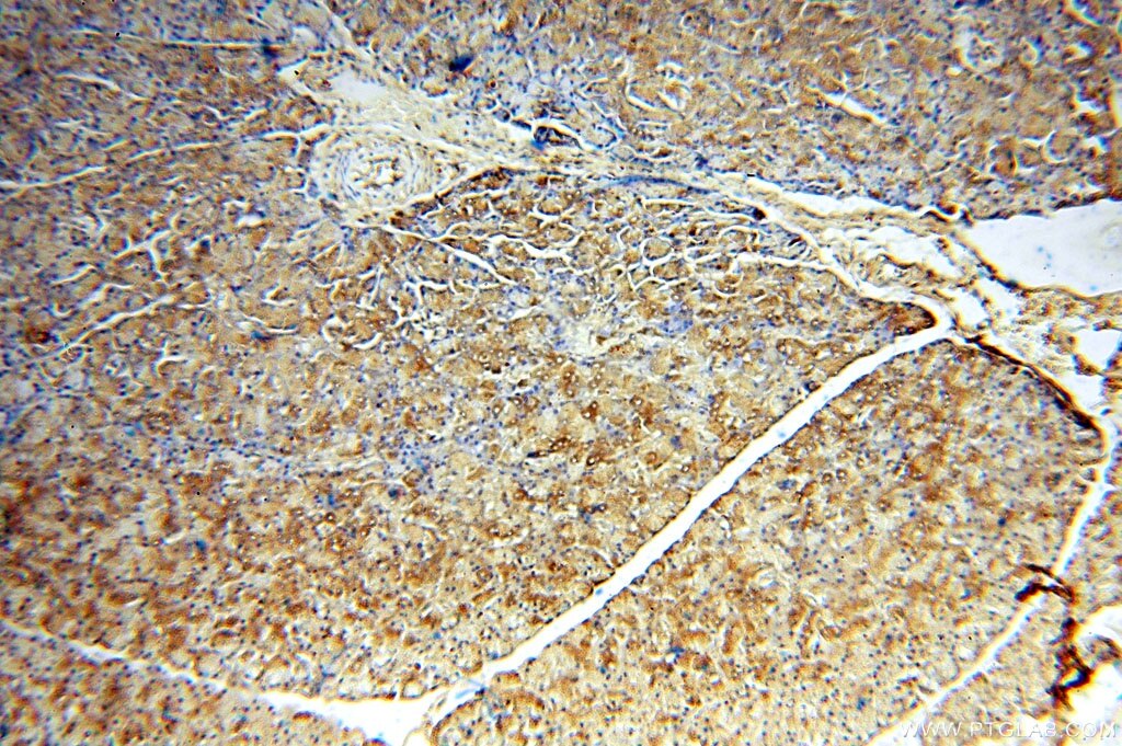 Immunohistochemistry (IHC) staining of human pancreas tissue using CUTC Polyclonal antibody (15030-1-AP)