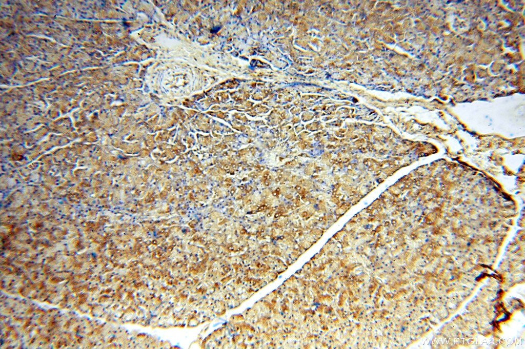 IHC staining of human pancreas using 15030-1-AP