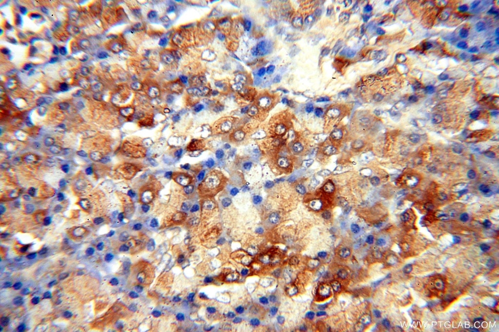 Immunohistochemistry (IHC) staining of human pancreas tissue using CUTC Polyclonal antibody (15030-1-AP)