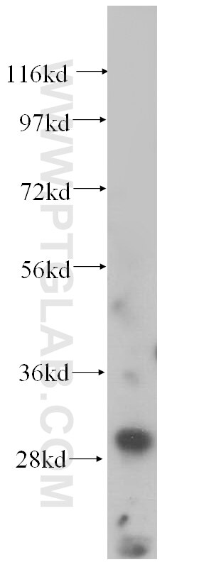 Western Blot (WB) analysis of HeLa cells using CUTC Polyclonal antibody (15030-1-AP)