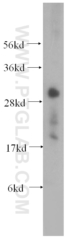 Western Blot (WB) analysis of mouse skeletal muscle tissue using CUTC Polyclonal antibody (15030-1-AP)