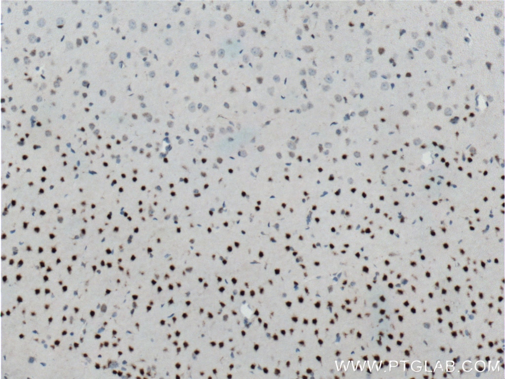 Immunohistochemistry (IHC) staining of mouse brain tissue using CUX1 Polyclonal antibody (11733-1-AP)