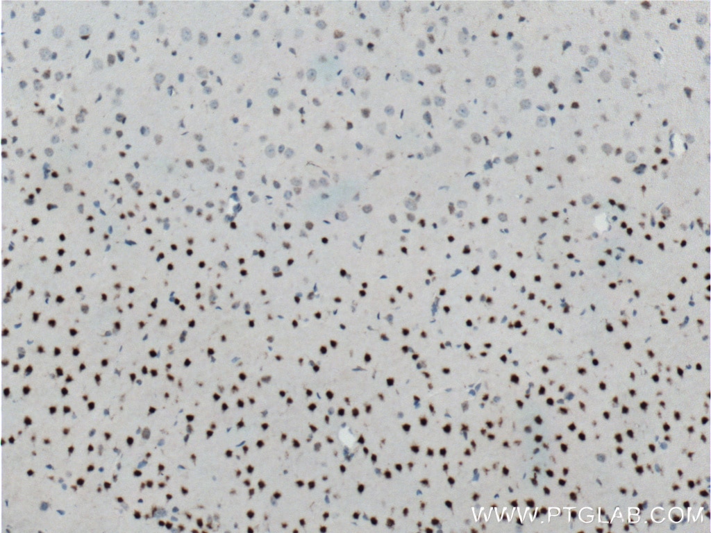 IHC staining of mouse brain using 11733-1-AP