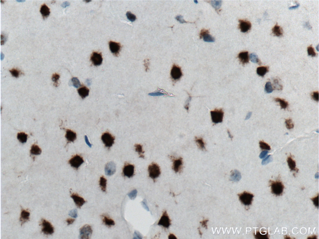 Immunohistochemistry (IHC) staining of mouse brain tissue using CUX1 Polyclonal antibody (11733-1-AP)