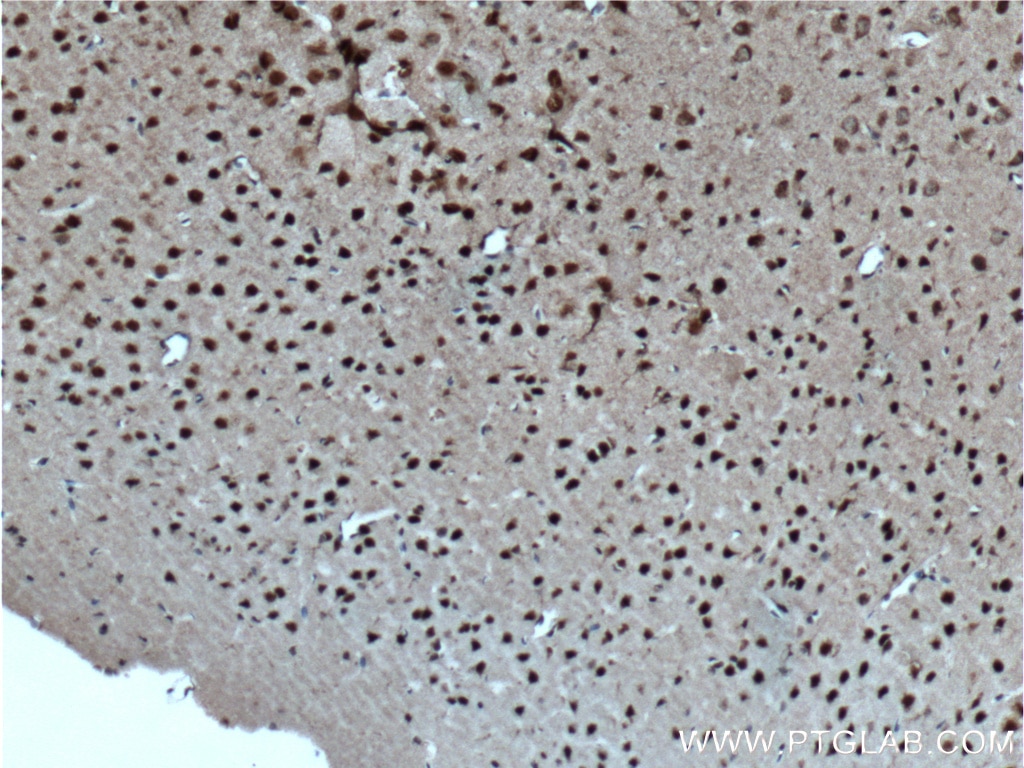 Immunohistochemistry (IHC) staining of mouse brain tissue using CUX1 Polyclonal antibody (11733-1-AP)