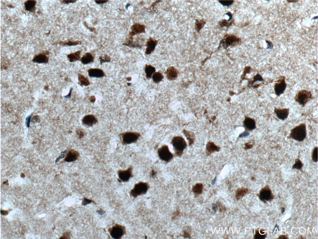 Immunohistochemistry (IHC) staining of mouse brain tissue using CUX1 Polyclonal antibody (11733-1-AP)