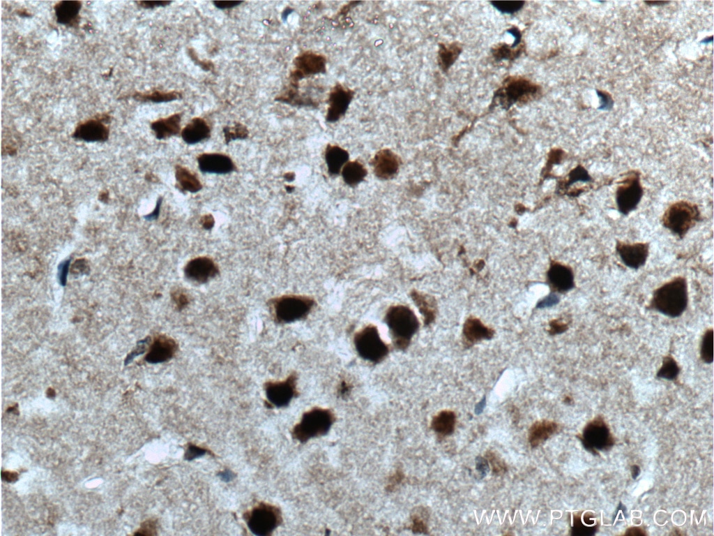 IHC staining of mouse brain using 11733-1-AP