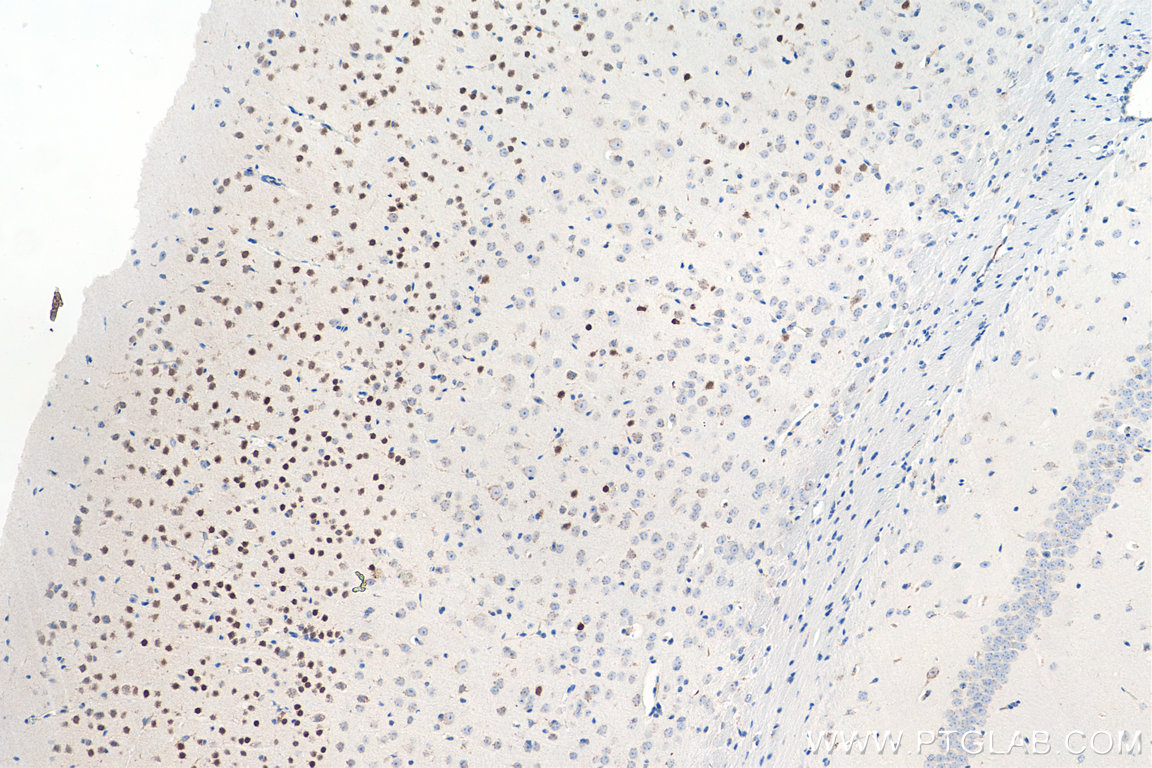 Immunohistochemistry (IHC) staining of mouse brain tissue using CUX1 Polyclonal antibody (11733-1-AP)