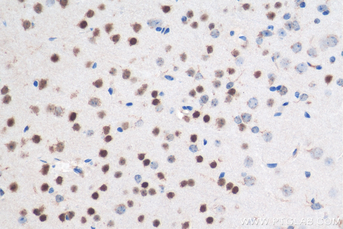 Immunohistochemistry (IHC) staining of mouse brain tissue using CUX1 Polyclonal antibody (11733-1-AP)