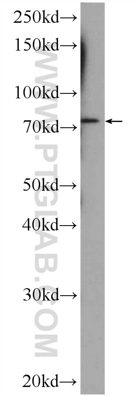 Western Blot (WB) analysis of mouse liver tissue using CUX1 Polyclonal antibody (11733-1-AP)