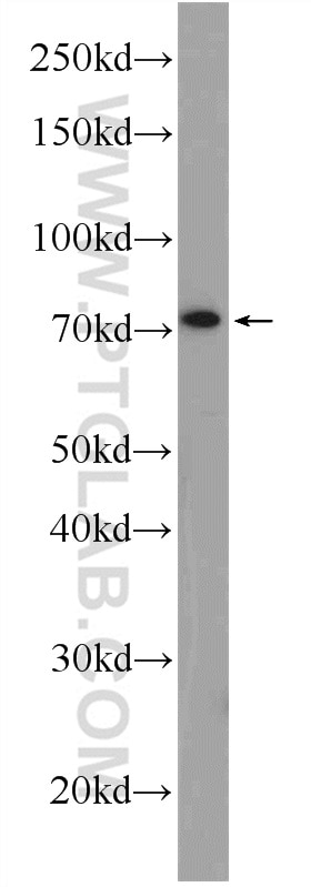 Western Blot (WB) analysis of rat brain tissue using CUX1 Polyclonal antibody (11733-1-AP)