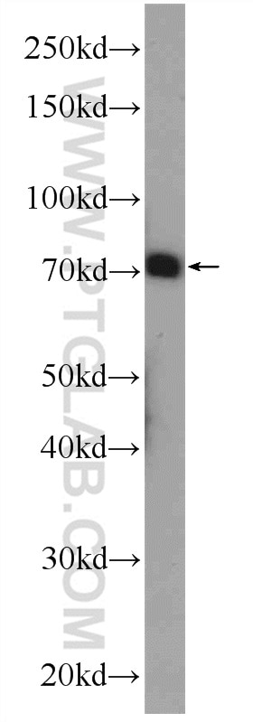 Western Blot (WB) analysis of mouse brain tissue using CUX1 Polyclonal antibody (11733-1-AP)