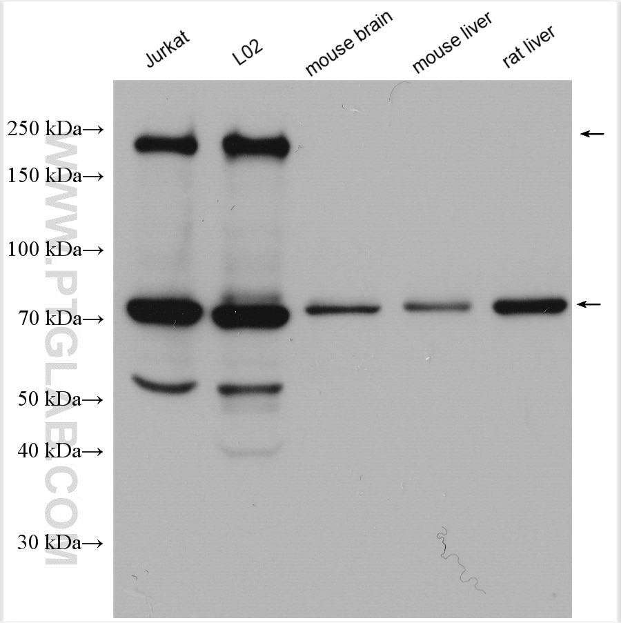Western Blot (WB) analysis of various lysates using CUX1 Polyclonal antibody (11733-1-AP)