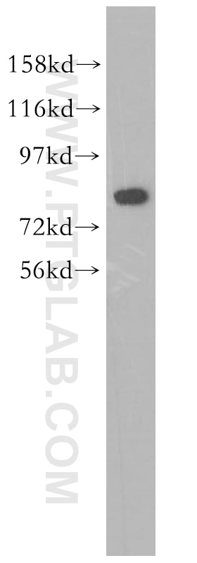 Western Blot (WB) analysis of human brain tissue using CUX1 Polyclonal antibody (11733-1-AP)