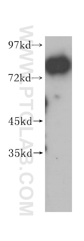 Western Blot (WB) analysis of human liver tissue using CUX1 Polyclonal antibody (11733-1-AP)